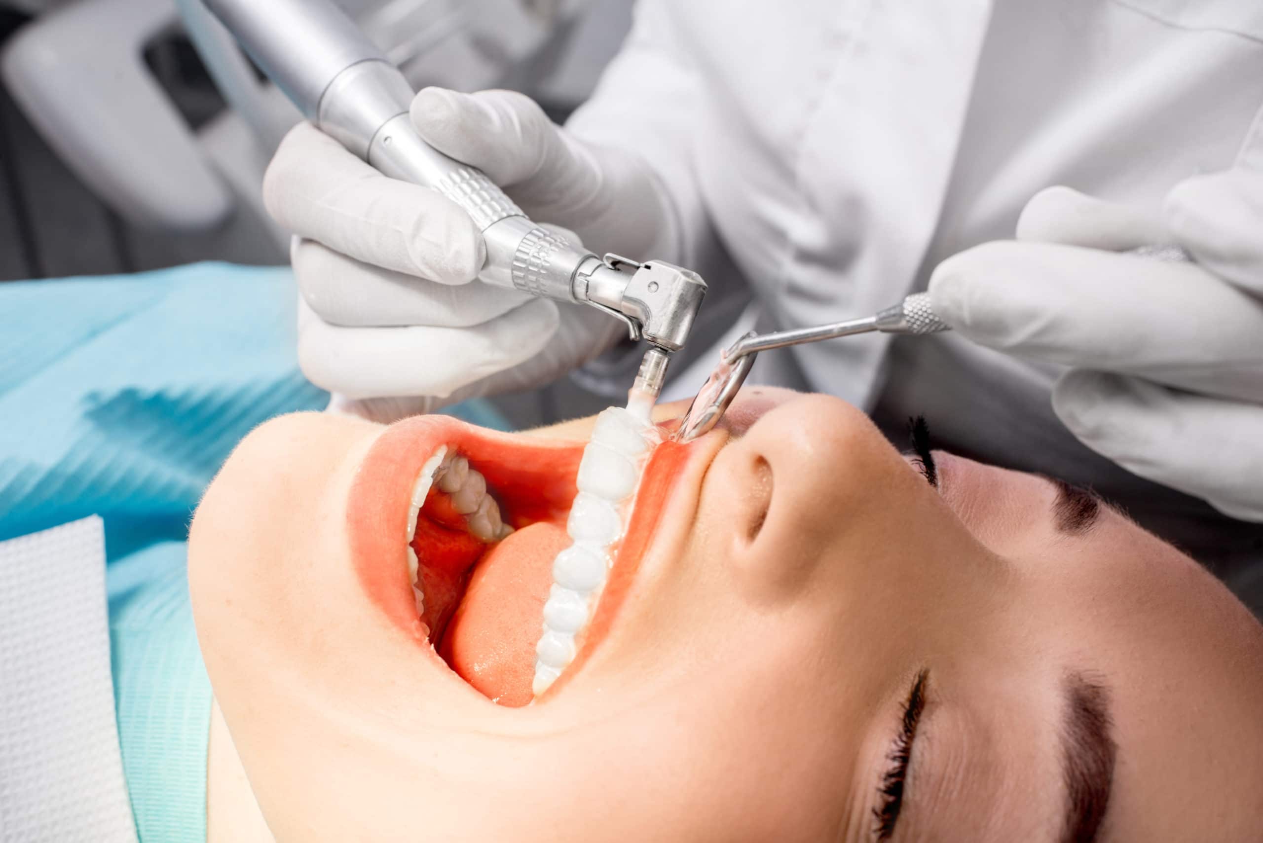 Why Regular Teeth Cleanings Are Important Crabtree Valley Dental